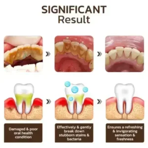 SmileFitPro™ Niacinamide Whitening Toothpaste