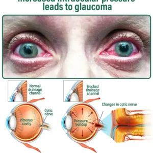 NESLEMY™ Nano Vision Repair Eye Serum ✅FDA Approved(Suitable for presbyopia, dry eye syndrome, glaucoma, and cataracts)