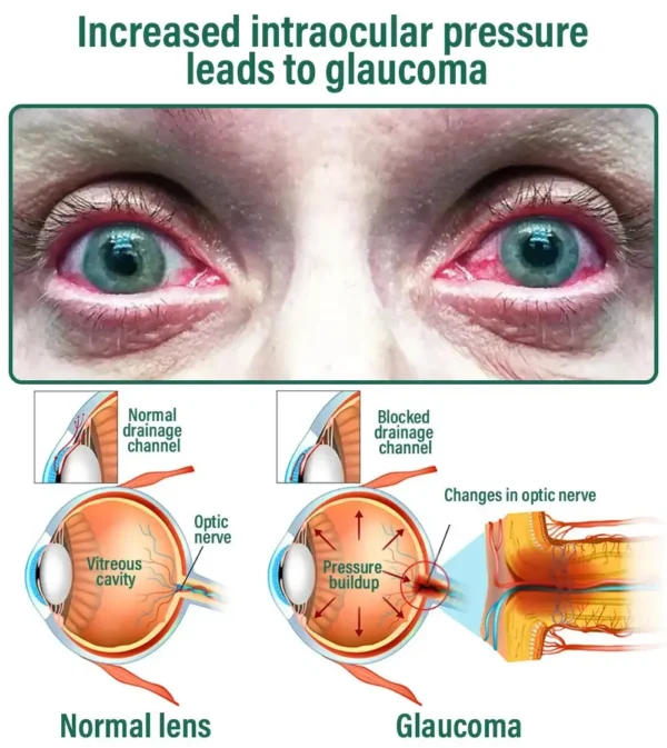 NESLEMY™ Nano Vision Repair Eye Serum ✅FDA Approved(Suitable for presbyopia, dry eye syndrome, glaucoma, and cataracts)