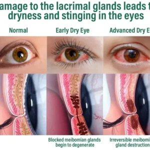 NESLEMY™ Nano Vision Repair Eye Serum ✅FDA Approved(Suitable for presbyopia, dry eye syndrome, glaucoma, and cataracts)