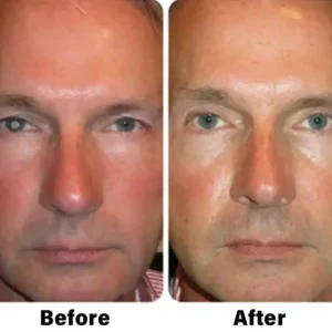 NESLEMY™ Nano Vision Repair Eye Serum ✅FDA Approved(Suitable for presbyopia, dry eye syndrome, glaucoma, and cataracts)