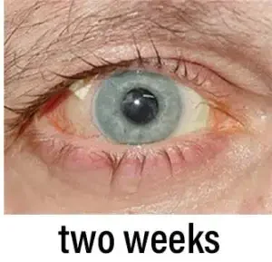 NESLEMY™ Nano Vision Repair Eye Serum ✅FDA Approved(Suitable for presbyopia, dry eye syndrome, glaucoma, and cataracts)