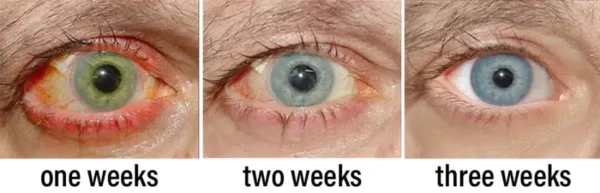 NESLEMY™ Nano Vision Repair Eye Serum ✅FDA Approved(Suitable for presbyopia, dry eye syndrome, glaucoma, and cataracts)
