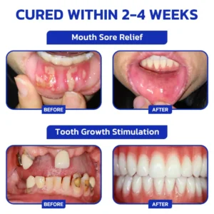 Smileasego™ ProWhite Enzyme Tooth Powder