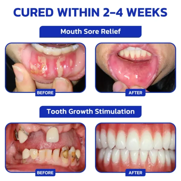 Smileasego™ ProWhite Enzyme Tooth Powder