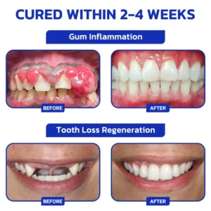Smileasego™ ProWhite Enzyme Tooth Powder