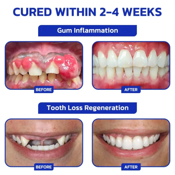 Smileasego™ ProWhite Enzyme Tooth Powder
