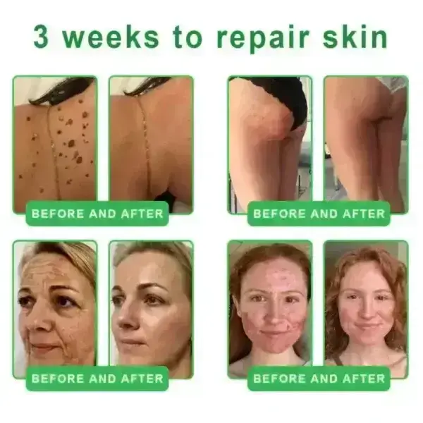 ๐๐ซ๐ข๐๐๐กยฎ ๐๐๐+ ๐-๐ข๐ง-๐ ๐๐๐ซ๐ฆ๐๐๐๐ฉ๐๐ข๐ซ ๐๐๐ซ๐ฎ๐ฆ ๐
๐๐ ๐๐๐ซ๐ญ๐ข๐๐ข๐๐ โ ๐
๐ข๐ซ๐ฆ๐ฌ ๐ฅ๐จ๐จ๐ฌ๐ ๐ฌ๐ค๐ข๐ง, ๐๐๐๐๐ฌ ๐๐ซ๐ฎ๐ข๐ฌ๐ข๐ง๐ ๐๐ง๐ ๐ฌ๐๐ง๐ข๐ฅ๐ ๐ฉ๐ฎ๐ซ๐ฉ๐ฎ๐ซ๐, ๐๐ง๐ ๐ข๐ฆ๐ฉ๐ซ๐จ๐ฏ๐๐ฌ ๐ค๐๐ซ๐๐ญ๐ข๐ง ๐๐ฎ๐ข๐ฅ๐๐ฎ๐ฉ, ๐ฌ๐๐๐จ๐ซ๐ซ๐ก๐๐ข๐ ๐๐๐ซ๐ฆ๐๐ญ๐ข๐ญ๐ข๐ฌ, ๐๐ง๐ ๐๐จ๐ฅ๐ฅ๐ข๐๐ฎ๐ฅ๐๐ซ ๐ค๐๐ซ๐๐ญ๐จ๐ฌ๐ข๐ฌ.