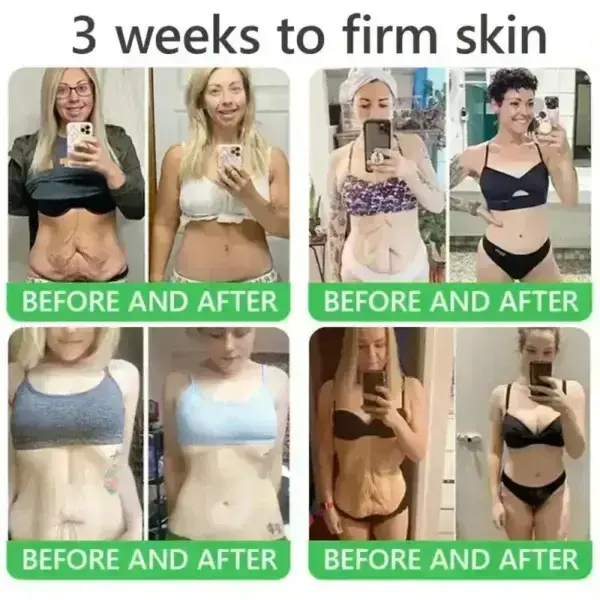 ๐๐ซ๐ข๐๐๐กยฎ ๐๐๐+ ๐-๐ข๐ง-๐ ๐๐๐ซ๐ฆ๐๐๐๐ฉ๐๐ข๐ซ ๐๐๐ซ๐ฎ๐ฆ ๐
๐๐ ๐๐๐ซ๐ญ๐ข๐๐ข๐๐ โ ๐
๐ข๐ซ๐ฆ๐ฌ ๐ฅ๐จ๐จ๐ฌ๐ ๐ฌ๐ค๐ข๐ง, ๐๐๐๐๐ฌ ๐๐ซ๐ฎ๐ข๐ฌ๐ข๐ง๐ ๐๐ง๐ ๐ฌ๐๐ง๐ข๐ฅ๐ ๐ฉ๐ฎ๐ซ๐ฉ๐ฎ๐ซ๐, ๐๐ง๐ ๐ข๐ฆ๐ฉ๐ซ๐จ๐ฏ๐๐ฌ ๐ค๐๐ซ๐๐ญ๐ข๐ง ๐๐ฎ๐ข๐ฅ๐๐ฎ๐ฉ, ๐ฌ๐๐๐จ๐ซ๐ซ๐ก๐๐ข๐ ๐๐๐ซ๐ฆ๐๐ญ๐ข๐ญ๐ข๐ฌ, ๐๐ง๐ ๐๐จ๐ฅ๐ฅ๐ข๐๐ฎ๐ฅ๐๐ซ ๐ค๐๐ซ๐๐ญ๐จ๐ฌ๐ข๐ฌ.