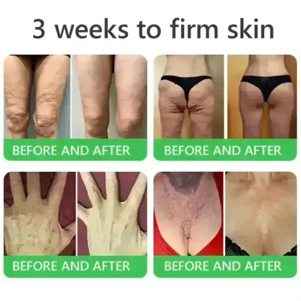 ๐๐ซ๐ข๐๐๐กยฎ ๐๐๐+ ๐-๐ข๐ง-๐ ๐๐๐ซ๐ฆ๐๐๐๐ฉ๐๐ข๐ซ ๐๐๐ซ๐ฎ๐ฆ ๐
๐๐ ๐๐๐ซ๐ญ๐ข๐๐ข๐๐ โ ๐
๐ข๐ซ๐ฆ๐ฌ ๐ฅ๐จ๐จ๐ฌ๐ ๐ฌ๐ค๐ข๐ง, ๐๐๐๐๐ฌ ๐๐ซ๐ฎ๐ข๐ฌ๐ข๐ง๐ ๐๐ง๐ ๐ฌ๐๐ง๐ข๐ฅ๐ ๐ฉ๐ฎ๐ซ๐ฉ๐ฎ๐ซ๐, ๐๐ง๐ ๐ข๐ฆ๐ฉ๐ซ๐จ๐ฏ๐๐ฌ ๐ค๐๐ซ๐๐ญ๐ข๐ง ๐๐ฎ๐ข๐ฅ๐๐ฎ๐ฉ, ๐ฌ๐๐๐จ๐ซ๐ซ๐ก๐๐ข๐ ๐๐๐ซ๐ฆ๐๐ญ๐ข๐ญ๐ข๐ฌ, ๐๐ง๐ ๐๐จ๐ฅ๐ฅ๐ข๐๐ฎ๐ฅ๐๐ซ ๐ค๐๐ซ๐๐ญ๐จ๐ฌ๐ข๐ฌ.