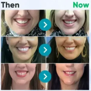 Rolimey® VioCore Bee Venom Dental Treatment Toothpaste