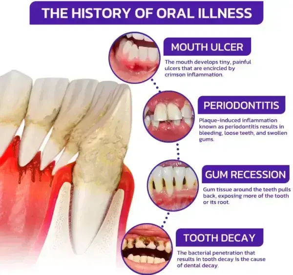 Rolimey® VioCore Bee Venom Dental Treatment Toothpaste