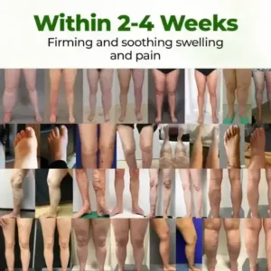 Timilk®Professional Leg Circulation Cream