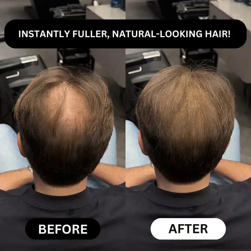 Lovilds™ Instant Hair Fibers: Thicker-Looking Hair in 30 Seconds