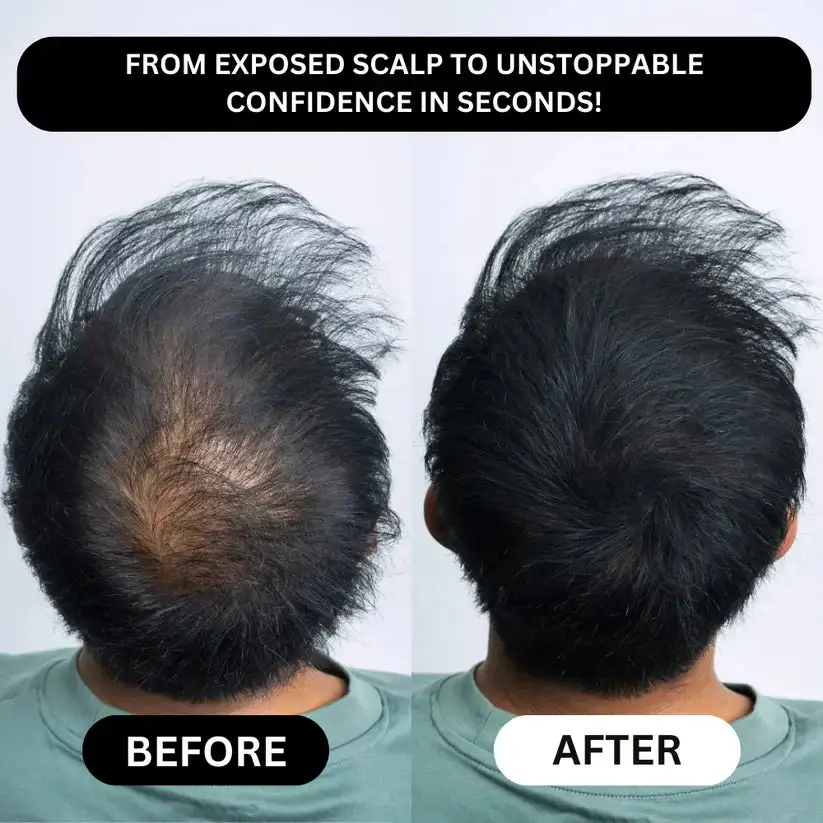 Lovilds™ Instant Hair Fibers: Thicker-Looking Hair in 30 Seconds