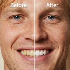 Smileasego™ — Instantly Whiter Smile🦷