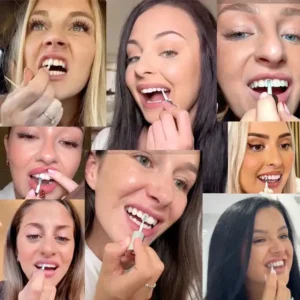 Smileasego™ — Instantly Whiter Smile🦷