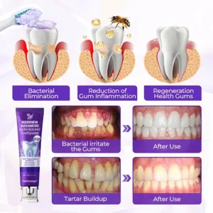 Smileasego® BeeRenew Advanced Gum Regeneration Toothpaste