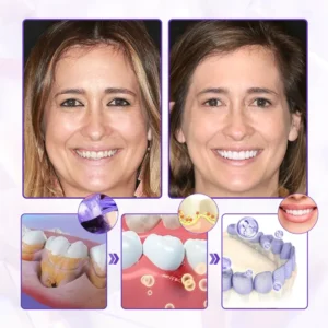 Smileasego® BeeRenew Advanced Gum Regeneration Toothpaste