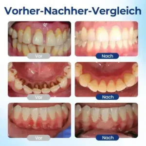 Biancat® BeeTakt Zahnfleisch-Repair Lösung