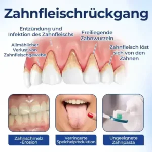 Biancat® BeeTakt Zahnfleisch-Repair Lösung