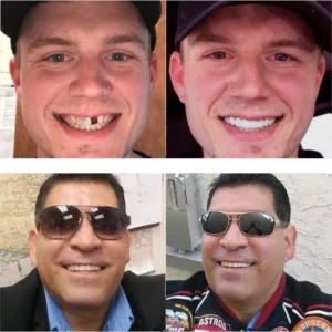 FLASH SALE: Fix Your Smile in 30 Seconds — 👨‍⚕Adjustable Snap-On Dentures😁