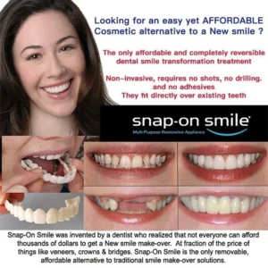 FLASH SALE: Fix Your Smile in 30 Seconds — 👨‍⚕Adjustable Snap-On Dentures😁