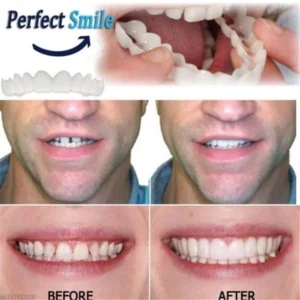 FLASH SALE: Fix Your Smile in 30 Seconds — 👨‍⚕Adjustable Snap-On Dentures😁