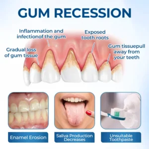 🔥Hot Sale,50% Off😁Oral Heal Drops-Bring Your Confident Smile Back