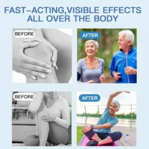 Skavix® Nano-Microneedle Joint Patch