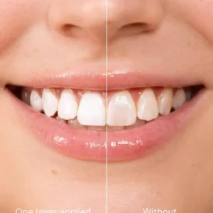 Smileasego™ Tooth Whitening - Instant Clean Smile