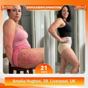 ALLYBEE® Moringa & Berberine 4-In-1 Micro-Particle Sculpting & Fat-Burn Shorts