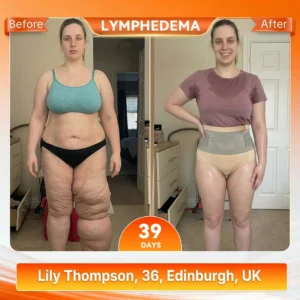 ALLYBEE® Moringa & Berberine 4-In-1 Micro-Particle Sculpting & Fat-Burn Shorts