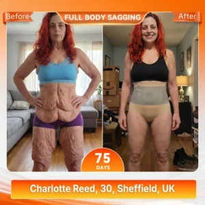 ALLYBEE® Moringa & Berberine 4-In-1 Micro-Particle Sculpting & Fat-Burn Shorts