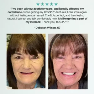🦷HazyGalaxy™ Custom-Fit Functional Dentures — Made in the USA, Up to 70% OFF for a More Confident Smile!