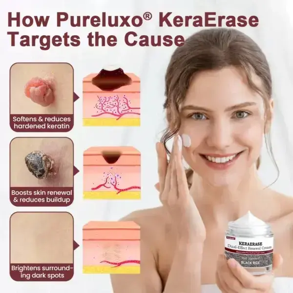 KeraErase Dual-Effect Renewal Cream
