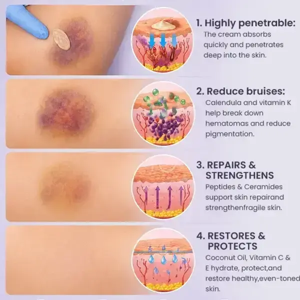 LIMETOW® Bruise Repair & Skin-Strengthening Cream