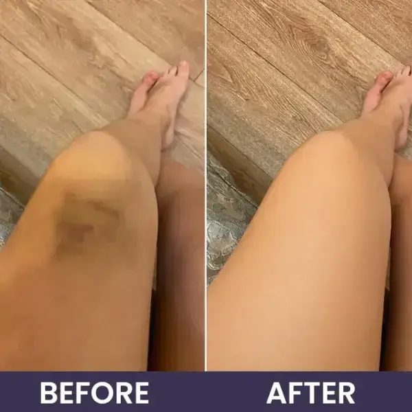 LIMETOW® Bruise Repair & Skin-Strengthening Cream