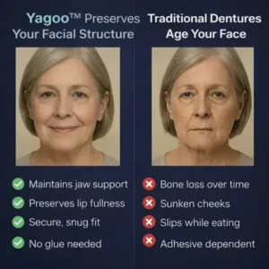 Yagoo™ PREMIUM FULL DENTURE SET